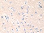 Epsin 1 Antibody in Immunohistochemistry (Paraffin) (IHC (P))