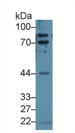 Epsin 1 Antibody in Western Blot (WB)