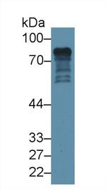 Epsin 1 Antibody in Western Blot (WB)