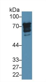 Epsin 1 Antibody in Western Blot (WB)