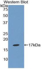 Epsin 1 Antibody in Western Blot (WB)
