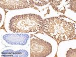 EEF1A1 Antibody in Immunohistochemistry (Paraffin) (IHC (P))
