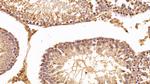 EEF1A1 Antibody in Immunohistochemistry (Paraffin) (IHC (P))