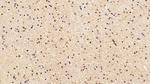 CRM1 Antibody in Immunohistochemistry (Paraffin) (IHC (P))