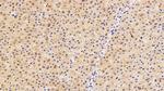 CRM1 Antibody in Immunohistochemistry (Paraffin) (IHC (P))