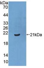 CRM1 Antibody in Western Blot (WB)