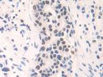 FAM19A3 Antibody in Immunohistochemistry (Paraffin) (IHC (P))