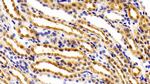 FEZ2 Polyclonal Antibody