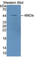 FEZ2 Antibody in Western Blot (WB)