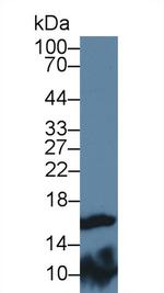 FABP9 Antibody in Western Blot (WB)