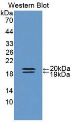 FABP9 Antibody in Western Blot (WB)