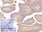 FADS2 Antibody in Immunohistochemistry (Paraffin) (IHC (P))