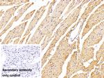 FADS2 Polyclonal Antibody