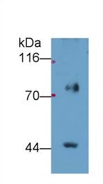 FADS2 Antibody in Western Blot (WB)