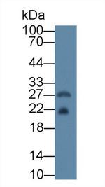 Ferritin Heavy Chain Antibody in Western Blot (WB)