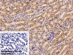 Ferritin Heavy Chain Polyclonal Antibody