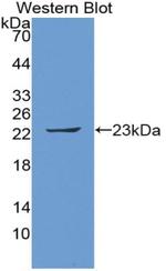 Ferritin Heavy Chain Antibody in Western Blot (WB)