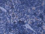 Ferritin Light Chain Antibody in Immunohistochemistry (Paraffin) (IHC (P))