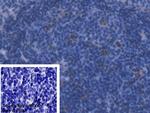 Ferritin Light Chain Polyclonal Antibody
