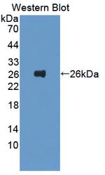Ferritin Light Chain Antibody in Western Blot (WB)