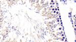 Fibrillarin Antibody in Immunohistochemistry (Paraffin) (IHC (P))