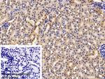 Fibrinogen Beta Chain Antibody in Immunohistochemistry (Paraffin) (IHC (P))