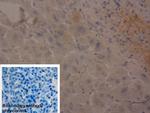 Fibrinogen Beta Chain Antibody in Immunohistochemistry (Paraffin) (IHC (P))