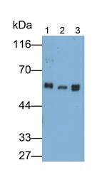 Fibrinogen Beta Chain Antibody in Western Blot (WB)