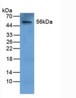 Fibrinogen Beta Chain Antibody in Western Blot (WB)