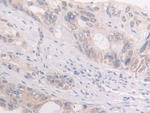 FKBP4 Polyclonal Antibody