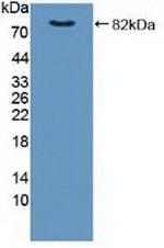 FKBP4 Antibody in Western Blot (WB)