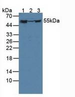 FKBP4 Antibody in Western Blot (WB)