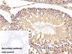 FKBPL Antibody in Immunohistochemistry (Paraffin) (IHC (P))