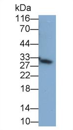 FLT3LG Antibody in Western Blot (WB)