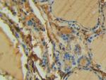 FAK Antibody in Immunohistochemistry (Paraffin) (IHC (P))