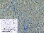 FAK Antibody in Immunohistochemistry (Paraffin) (IHC (P))