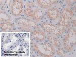 FOLR1 Antibody in Immunohistochemistry (Paraffin) (IHC (P))