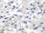 Fumarase Antibody in Immunohistochemistry (Paraffin) (IHC (P))