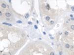 Fumarase Antibody in Immunohistochemistry (Paraffin) (IHC (P))