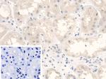 Fumarase Antibody in Immunohistochemistry (Paraffin) (IHC (P))