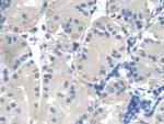 Fumarase Antibody in Immunohistochemistry (Paraffin) (IHC (P))