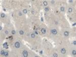 Fumarase Antibody in Immunohistochemistry (Paraffin) (IHC (P))