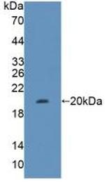 Fumarase Antibody in Western Blot (WB)