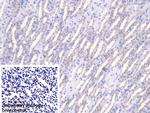 Fumarase Polyclonal Antibody