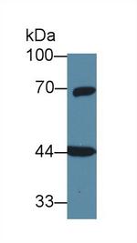 GNA11 Antibody in Western Blot (WB)