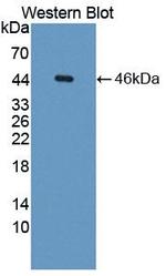 GNA11 Antibody in Western Blot (WB)