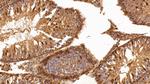 Galectin 1 Antibody in Immunohistochemistry (Paraffin) (IHC (P))