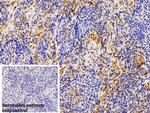 Galectin 1 Antibody in Immunohistochemistry (Paraffin) (IHC (P))