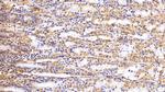 Galectin 1 Antibody in Immunohistochemistry (Paraffin) (IHC (P))