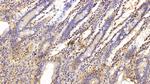 Galectin 1 Antibody in Immunohistochemistry (Paraffin) (IHC (P))